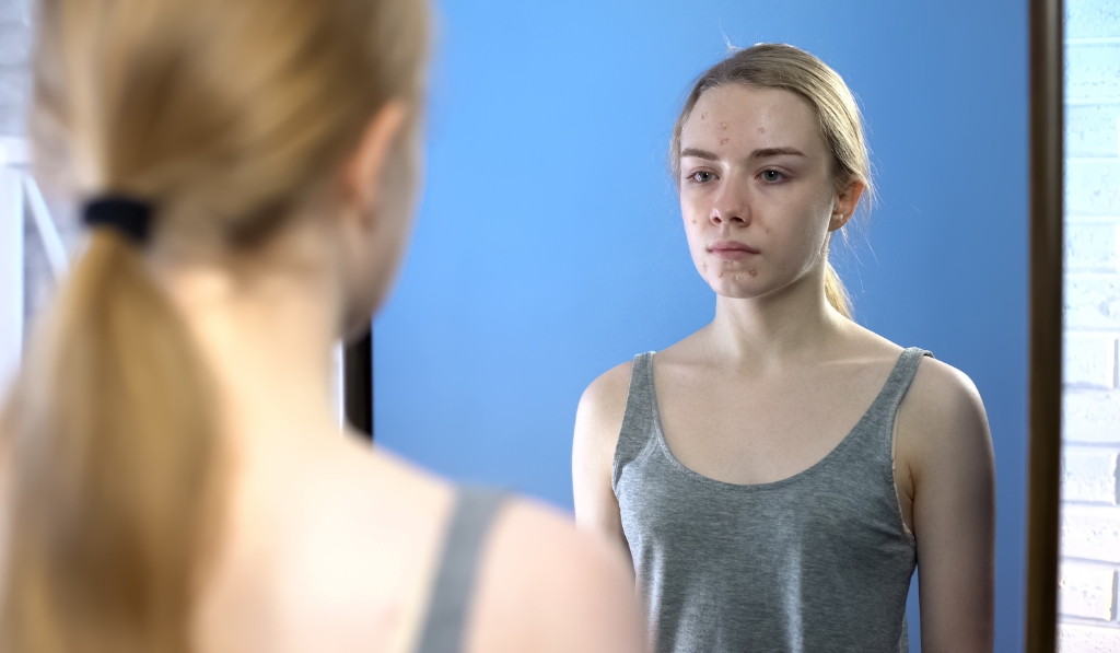 What Is Body Dysmorphia? Signs, Causes & Treatment